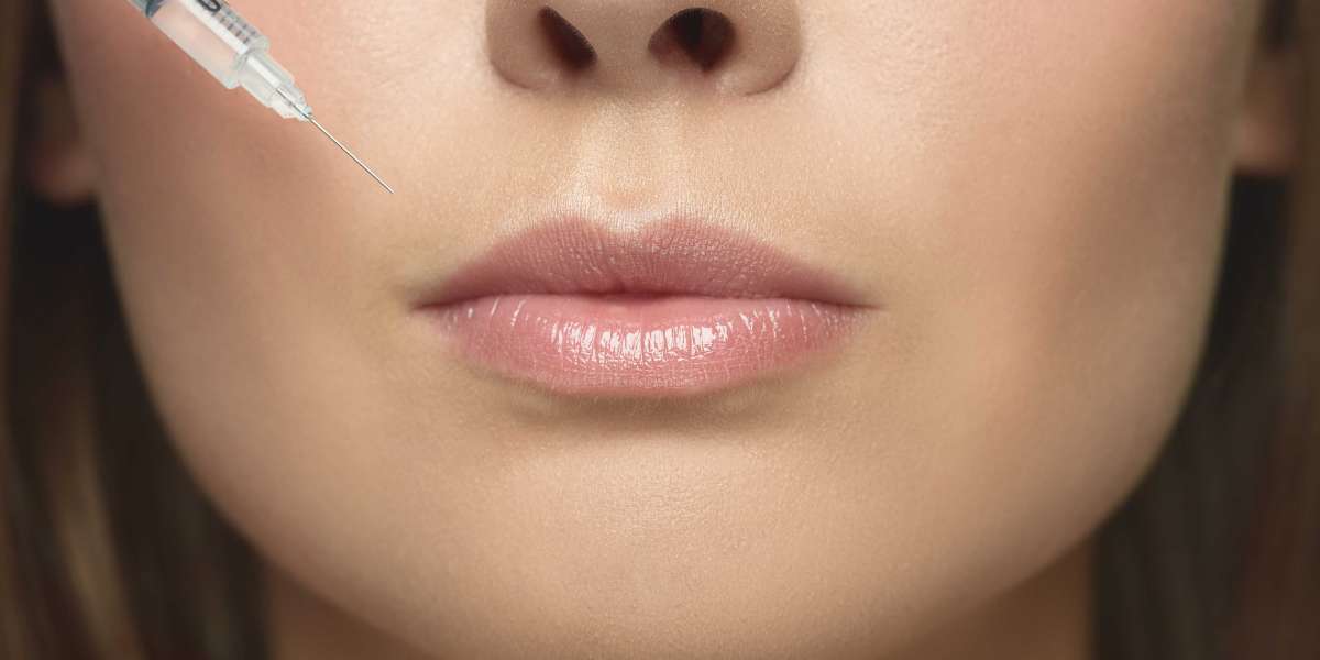 Preenchimento Labial Braga: Tudo o Que Precisa de Saber